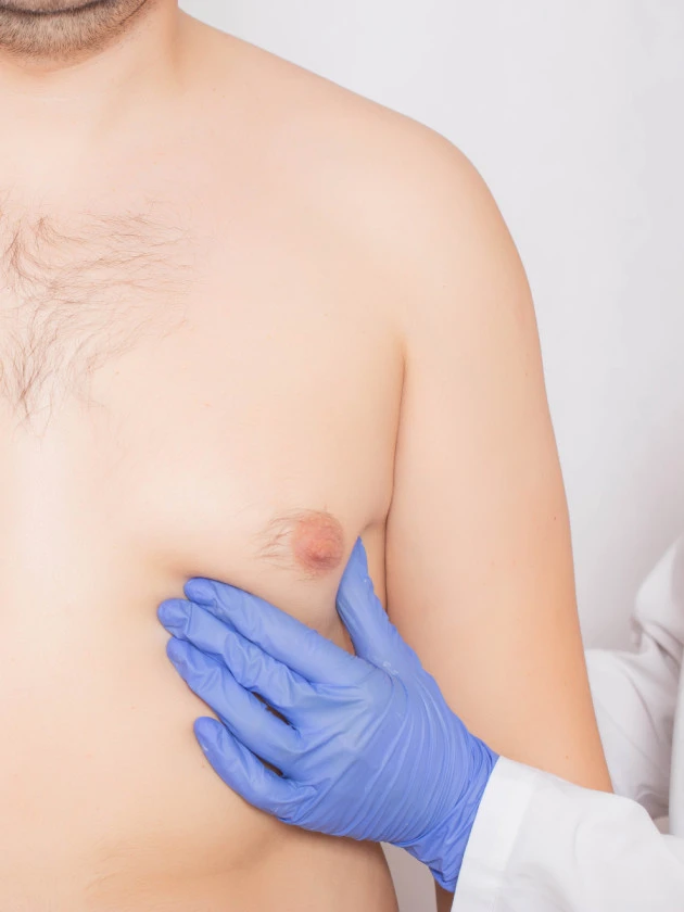 Mastectomy for Gynecomastia  | General Surgery in Boise, Meridian, Caldwell